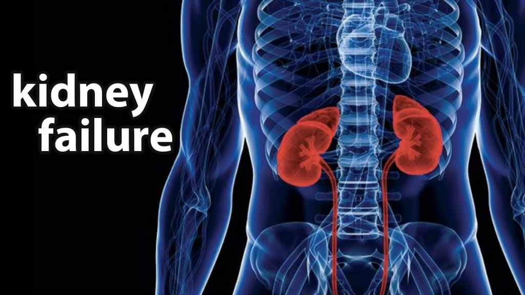 Support Your Kidneys Naturally: 4 Effective&nbsp;Strategies